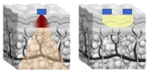 رادیوفرکانسی
